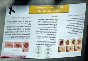 melanoma